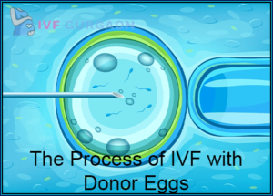 The Process of IVF with Donor Eggs